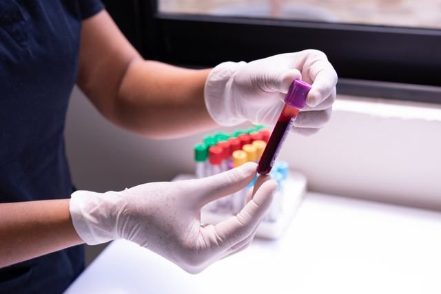 blood test sample